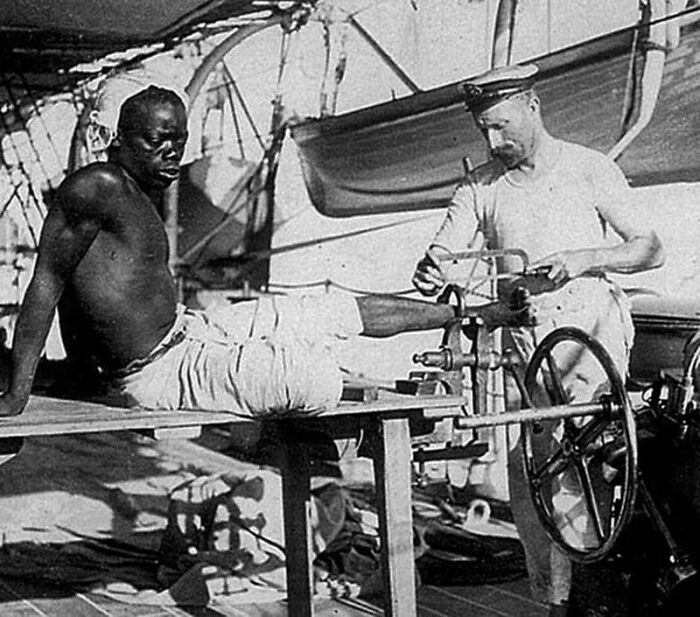 A historical photo depicting a man with a prosthetic leg, an interesting and heartbreaking moment from history.