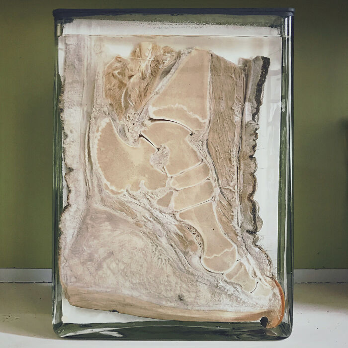 An interesting photo of an object cut in half: a human foot preserved in a jar, revealing bones and tissue.