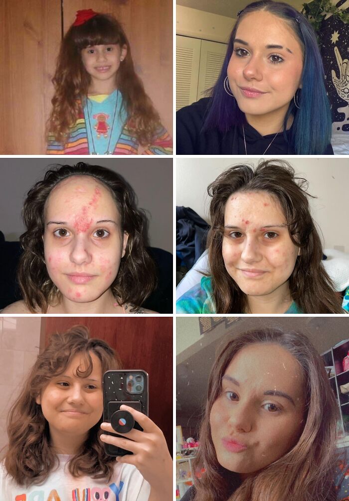 Multiple images showing women with red hair, blue hair, acne, and clear skin, displaying incredible transformations.
