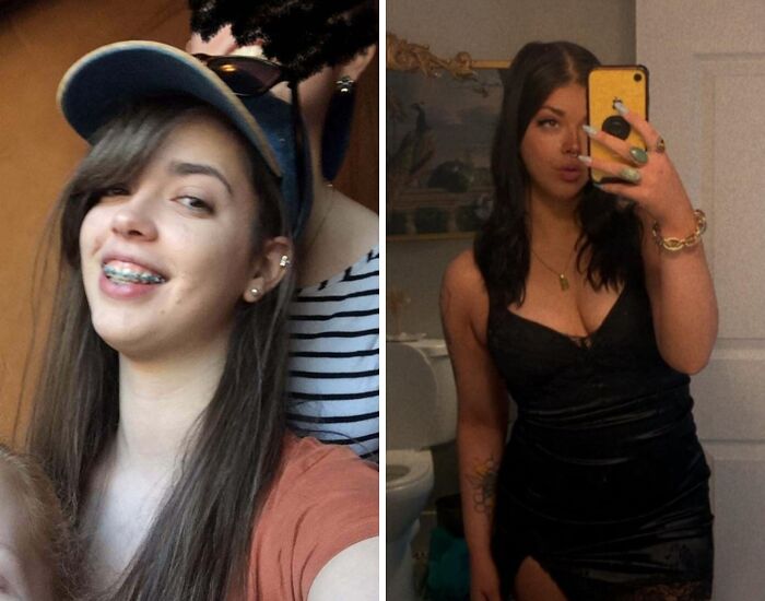 An ugly duckling transformation featuring a young woman with braces, then a confident woman in a black dress.
