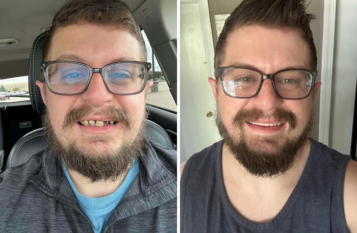 A man with glasses and an unkempt beard undergoing an incredible transformation to a neat beard and smile.