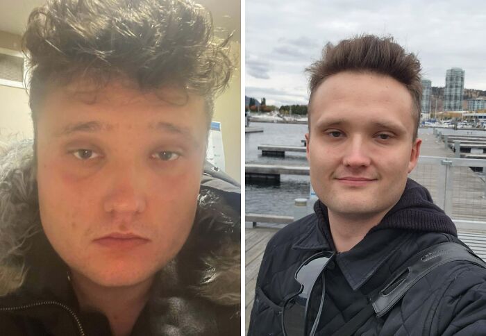Young man's stunning transformation, evolving from an ugly duckling look to a confident appearance by the water.
