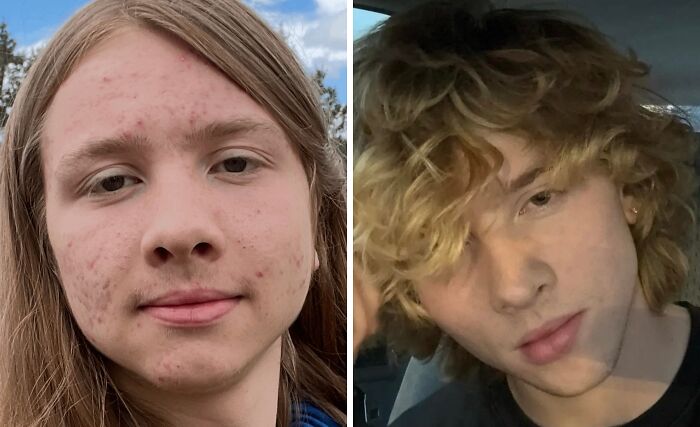Before and after pictures of an Ugly Ducklings transformation, illustrating a young man's incredible glow up.