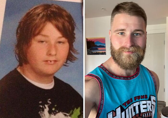 An Ugly Ducklings transformation: before and after photo of a man evolving from awkward teen to confident adult.