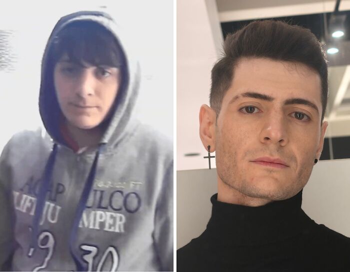 A man's incredible transformation from a hooded 'ugly duckling' to a stylish, well-groomed individual.