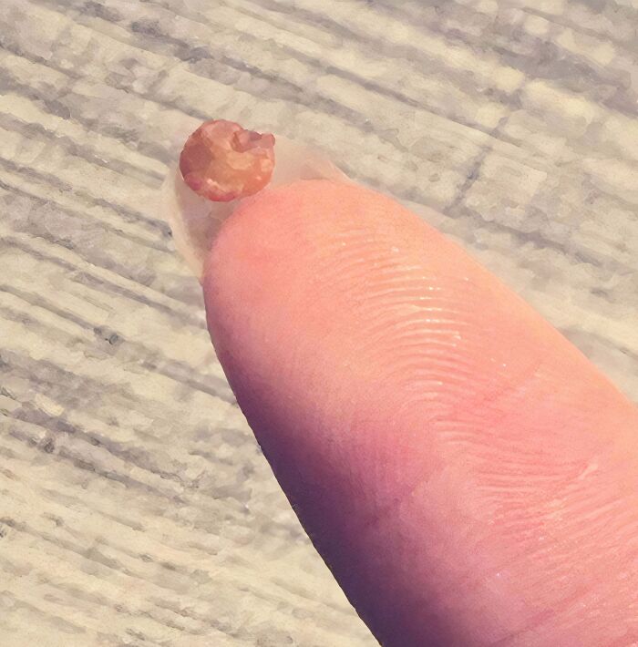 A baffling image of a tiny, translucent object, possibly a stone, held on a fingertip.