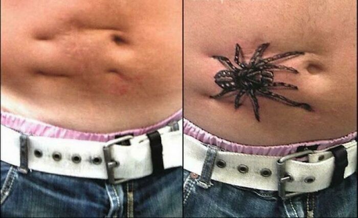 Before and after image of a tattoo cover-up transforming a belly button area into a realistic 3D spider.
