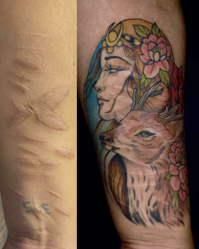 A before-and-after image showing scarred skin transformed into a beautiful tattoo cover-up of a woman with a deer.