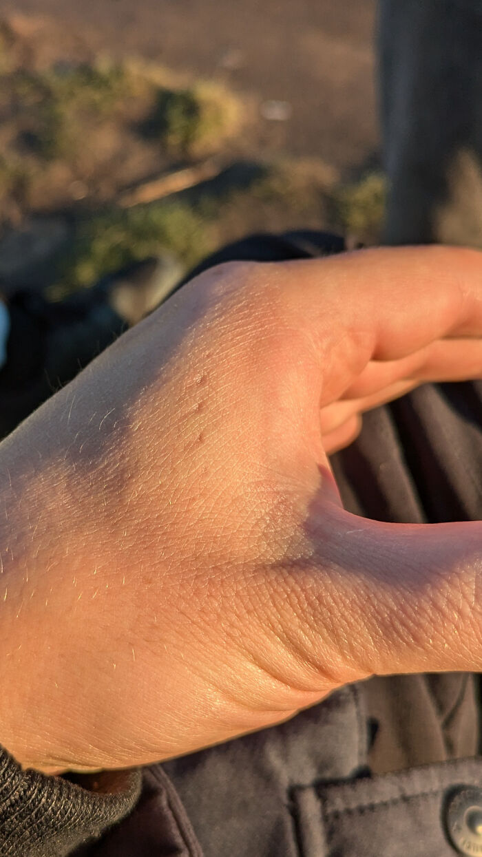 A human hand with visible skin texture and tiny bumps, illuminated by sunlight, an unexpected moment.