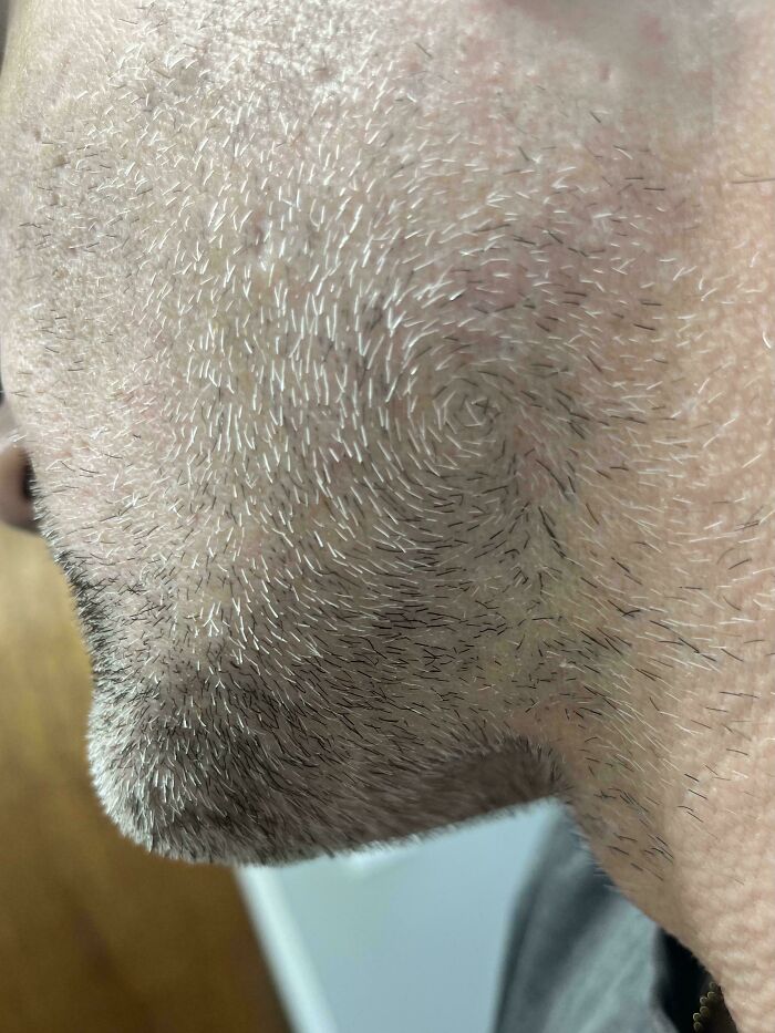 Close-up of a person's head with a weird hair swirl on the side, an interesting and unexpected moment.