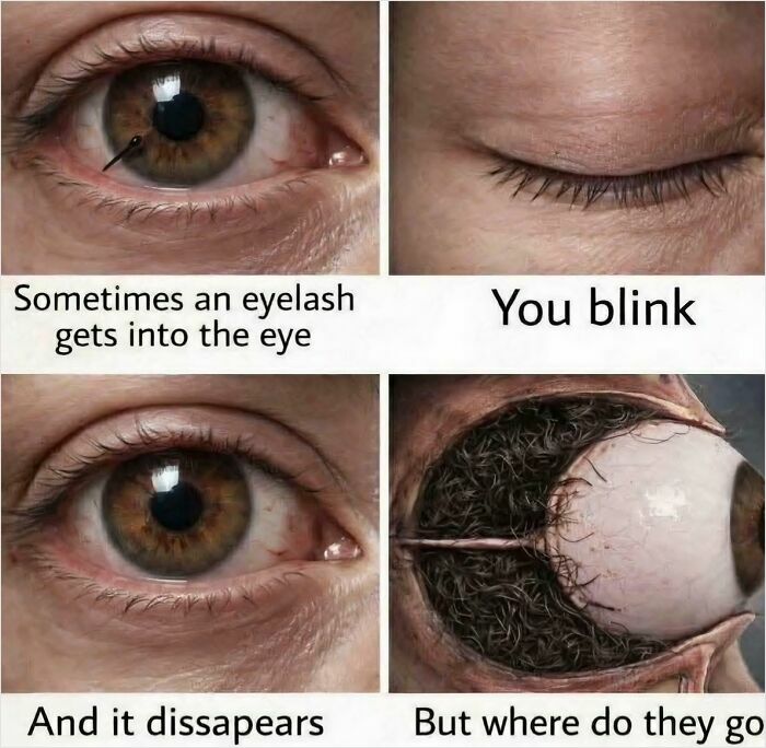 Cursed AI image depicting an eyelash disappearing into a hair-filled eyeball