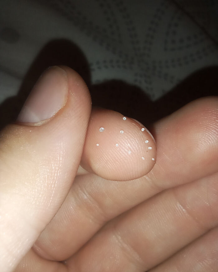 Small white crystals on a person's fingertips, illustrating a tiny, perhaps insignificant detail, yet possibly reflecting a broader lack of hope for humanity.