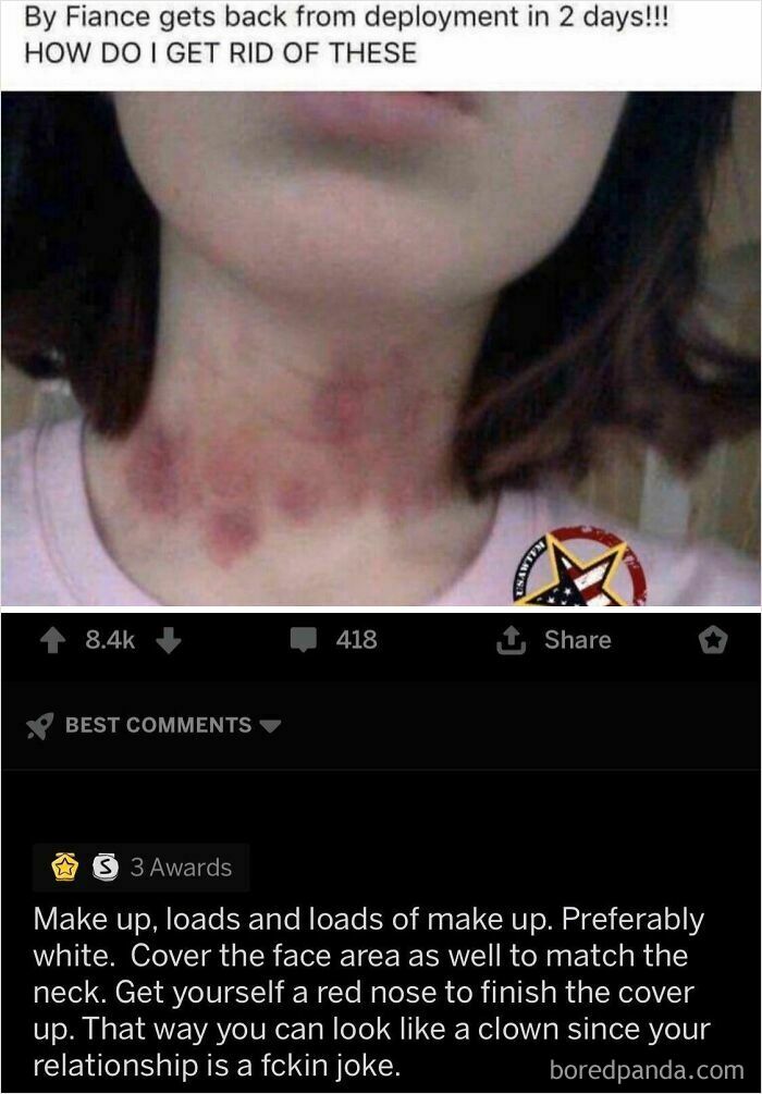 A person with hickeys on their neck asking for advice to cover them up, receiving an oddly specific roast.