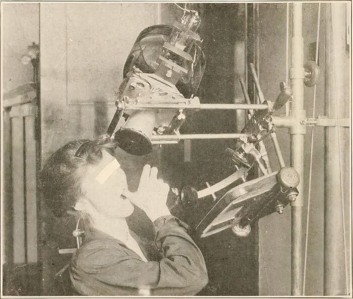 A woman undergoing medical treatment with early X-ray equipment, a terrifying method doctors used in the past.
