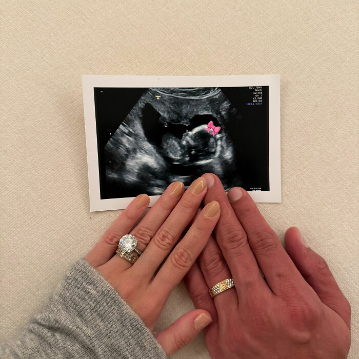 Pregnant influencer shows off ultrasound image with two hands wearing engagement rings, symbolizing the billionaire baby's dad.