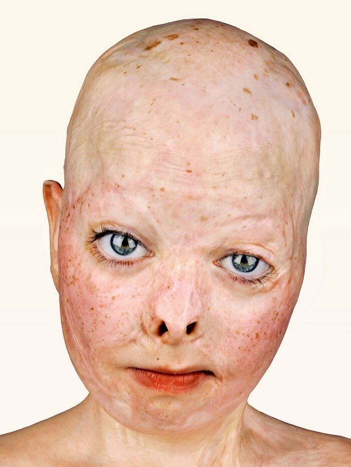 An intense portrait by Brock Elbank of a person with a bald head and freckles, revealing the stories behind faces.