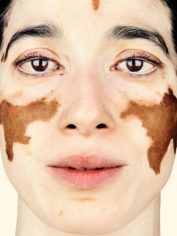 A striking portrait by Brock Elbank of a woman with unique facial markings, capturing the essence of faces and appearance.