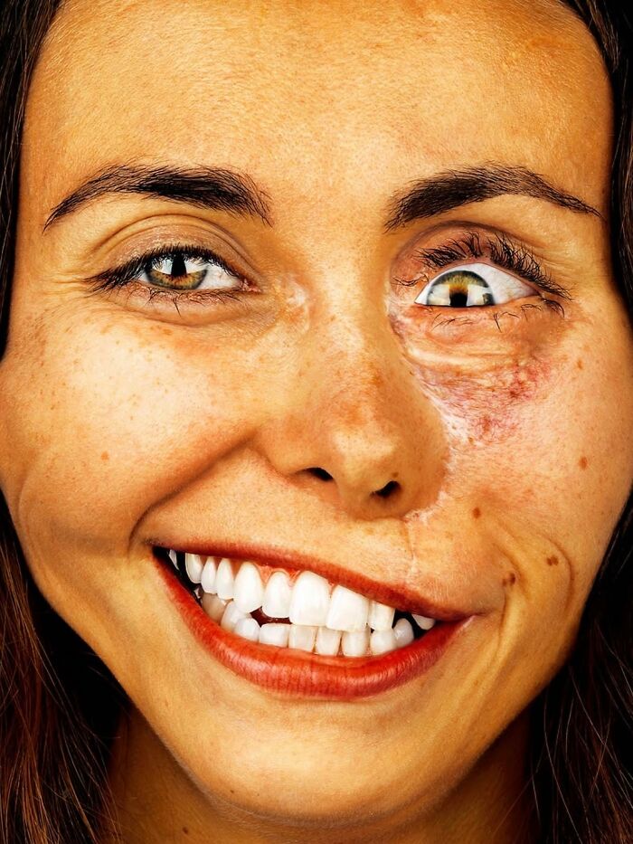 A close-up portrait by Brock Elbank showing a smiling woman with a distinct eye, celebrating faces and appearance.