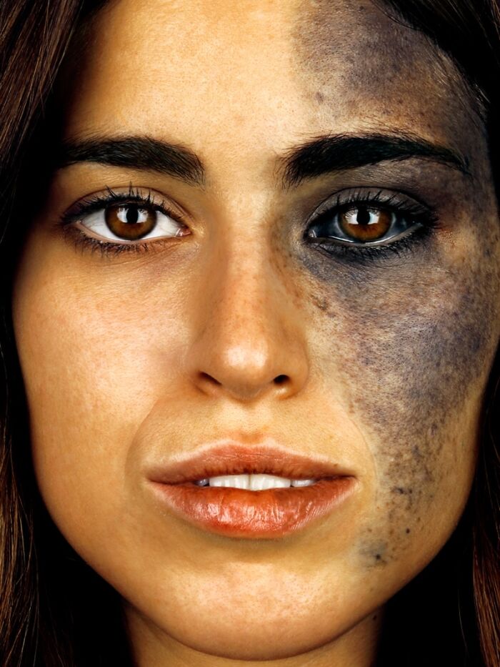 A powerful portrait by Brock Elbank depicting a woman's face half discolored, revealing the complex stories behind faces.