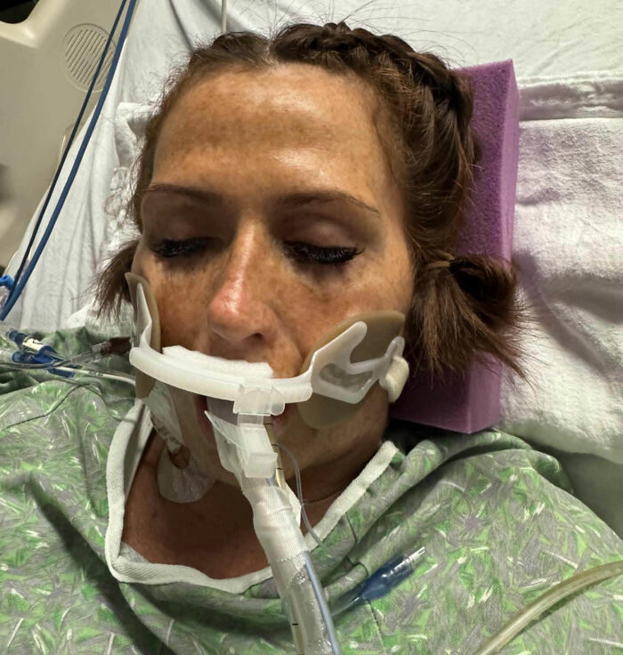 A woman hospitalized with tubes, warning women about common pre-swim habits and flesh-eating bacteria. A woman hospitalized with tubes, warning women about common pre-swim habits and flesh-eating bacteria.