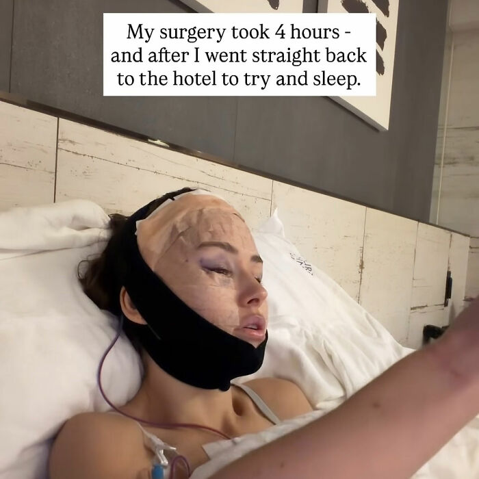 How Young Is Too Young To Get A Korean Facelift? Netizens Criticize Influencer's Decision After Recovery Posts How Young Is Too Young To Get A Korean Facelift? Netizens Criticize Influencer's Decision After Recovery Posts