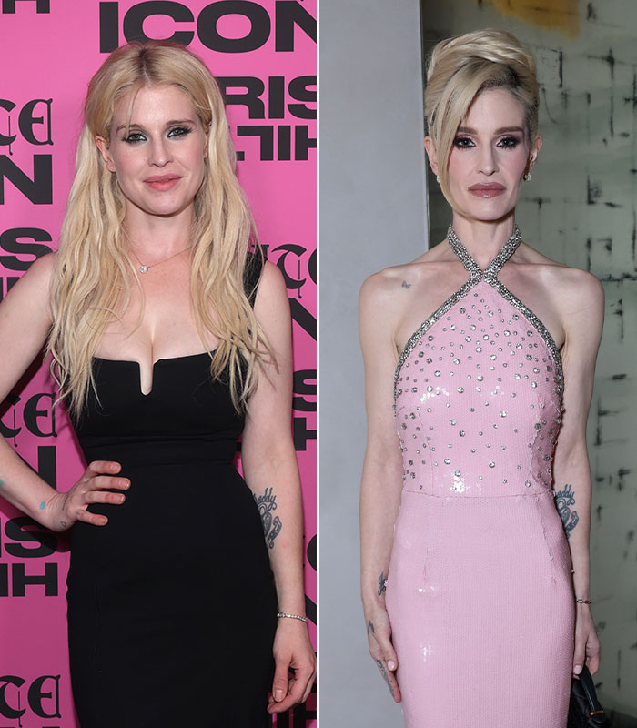 Ireland Baldwin, a celebrity woman, shows a striking weight transformation, sparking discussions about health and doctor-revealed risks.