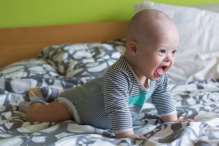 A baby with Down syndrome on a bed, happily looking up and smiling. The baby has a heartwarming update.
