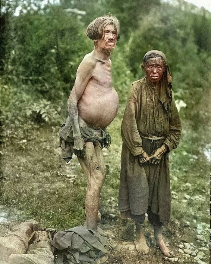 A stark image of two people, a very thin man with a distended stomach and an elderly woman, representing moments nearly lost to history.