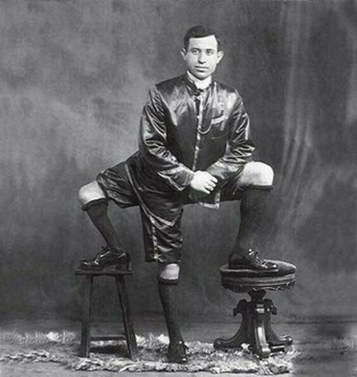 A man with three legs stands with one foot on a stool, a moment nearly lost to history.