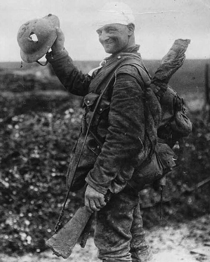A WWI soldier with a bandaged head holds up his helmet, a moment nearly lost to history.