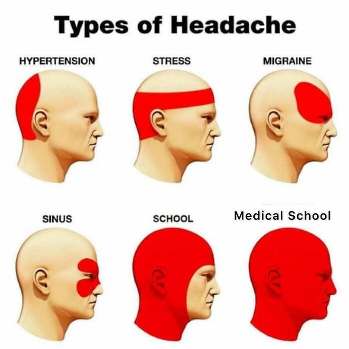 Funny medical meme illustrating different types of headaches, with medical school causing a full-head ache.