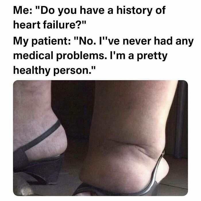 A funny medical meme showing extremely swollen feet despite a patient claiming no medical problems or heart failure.