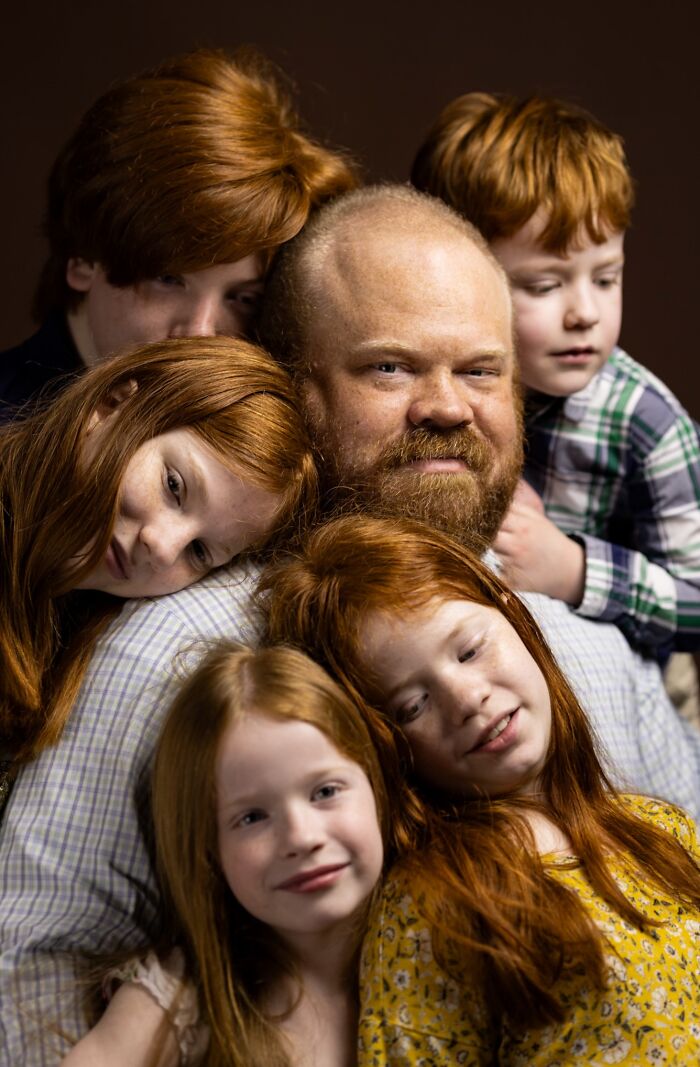A heartwarming family portrait of a father and his four children, all natural redheads, celebrating their unique beauty.