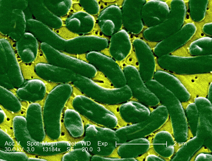 Microscopic image of flesh-eating bacteria, warning women about common pre-swim habits. Microscopic image of flesh-eating bacteria, warning women about common pre-swim habits.