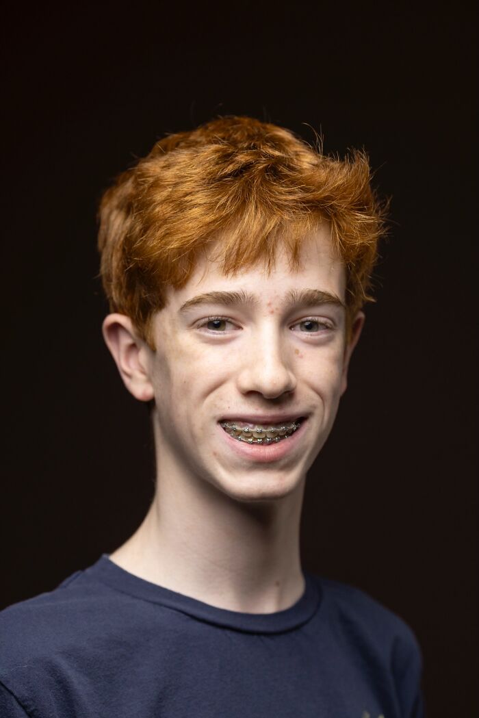 A smiling natural redhead boy with braces, celebrating natural redheads.