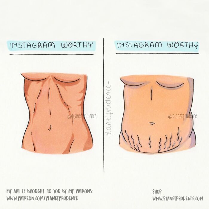 Artist illustrates what being a woman is like, contrasting smooth vs. stretch-marked bellies as Instagram worthy.