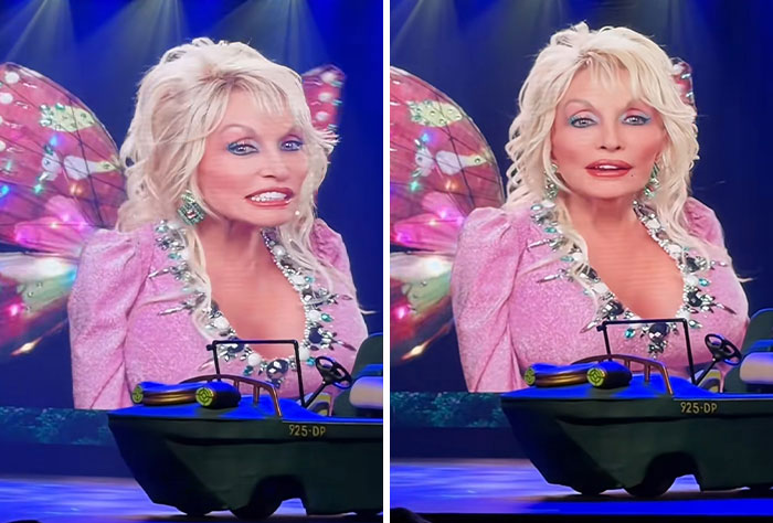 Dolly Parton in a pink dress with butterfly wings, making a selfless offer to doctors during her cancer battle. Dolly Parton in a pink dress with butterfly wings, making a selfless offer to doctors during her cancer battle.