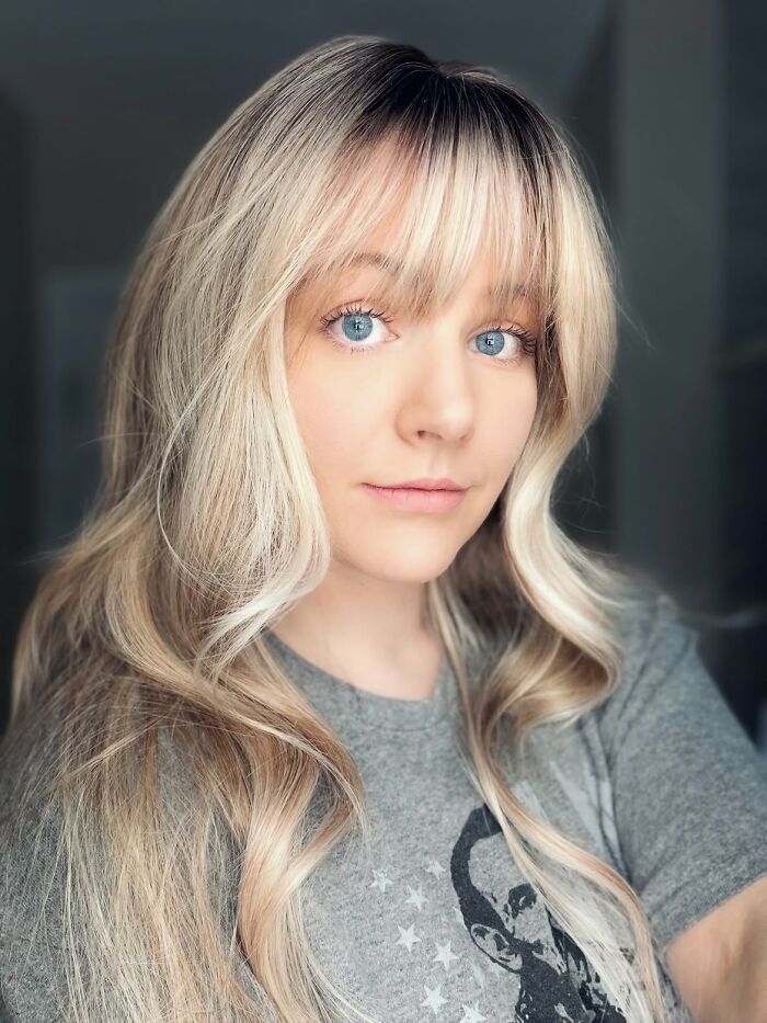 A mother of four, diagnosed with Down Syndrome, with blonde hair and blue eyes, looking at the camera. A mother of four, diagnosed with Down Syndrome, with blonde hair and blue eyes, looking at the camera.