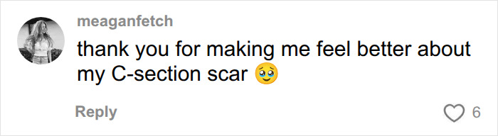 A comment expressing gratitude for feeling better about a C-section scar, related to pregnancy speculation. A comment expressing gratitude for feeling better about a C-section scar, related to pregnancy speculation.