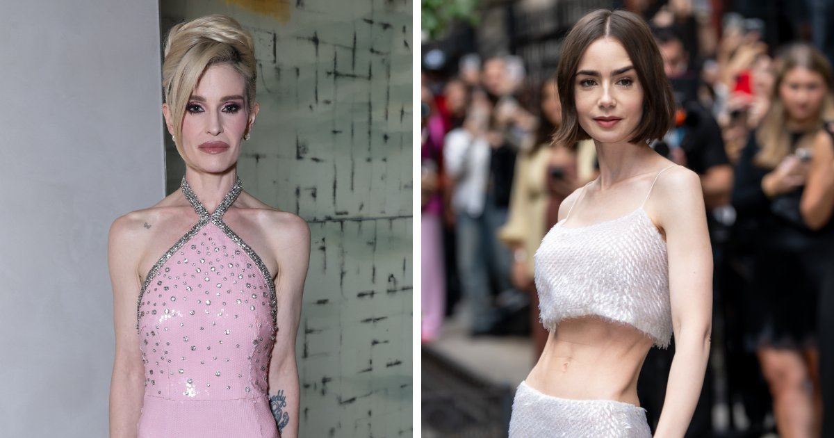 10 Celebridades cuya transformación preocupa a los fans: explicación de los riesgos de esta tendencia