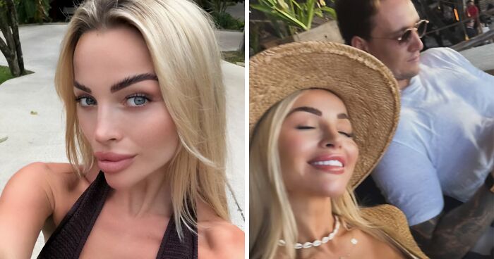 “Man Next To Your Bed”: Young Woman Urges Travelers To Be Careful After Nightmare Bali Experience