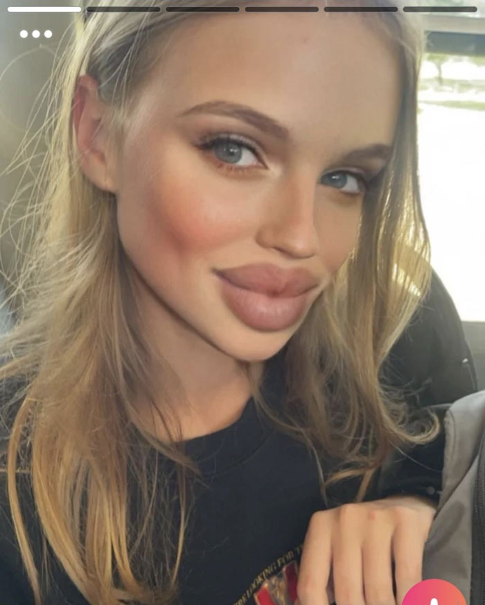 A close-up of a woman with large lips, potentially a wild and cringey online dating profile picture.
