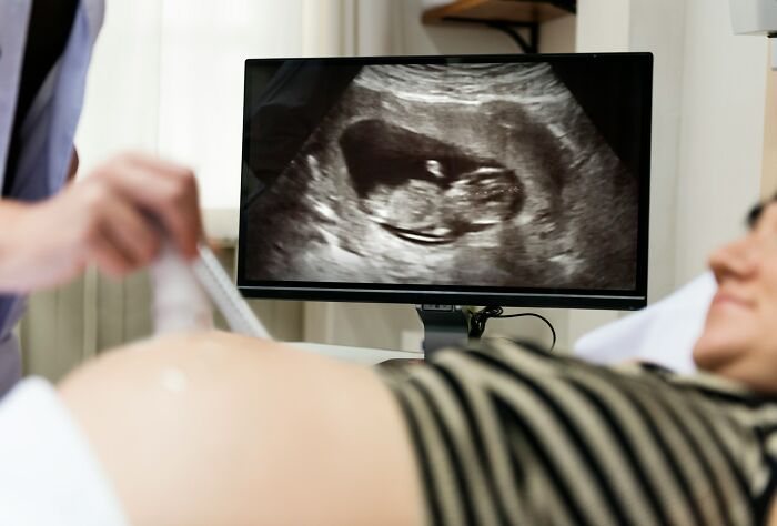 A pregnant woman undergoing an ultrasound, potentially revealing a difficult diagnosis for doctors.