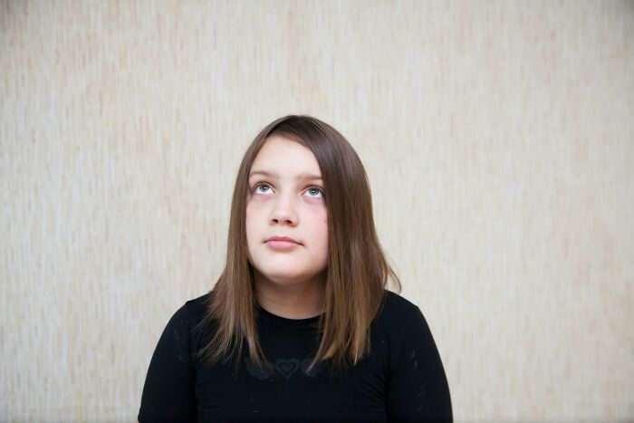 A young girl with long brown hair looking upwards with a pensive expression, representing complex MILs.