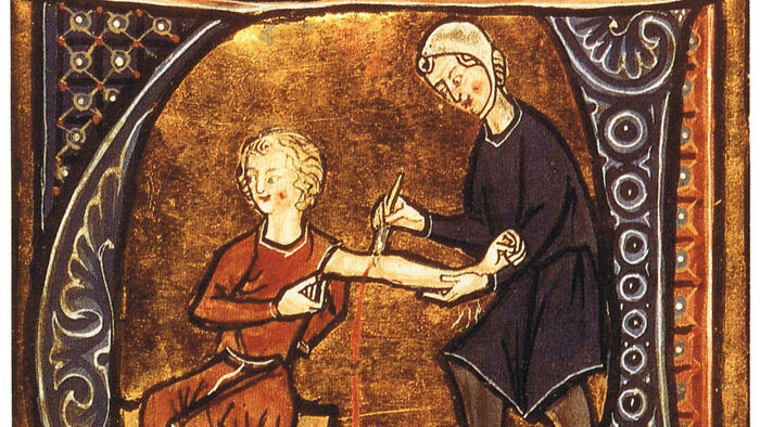 A medieval illustration of doctors treating patients by bloodletting, showcasing terrifying methods of the past.