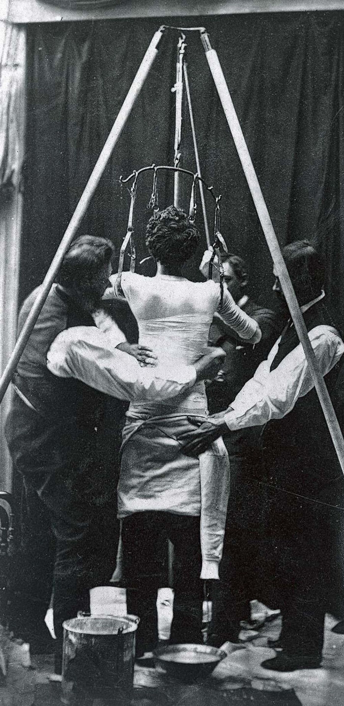 A historical photo of doctors using terrifying methods: suspending a patient for treatment, likely for spinal conditions.