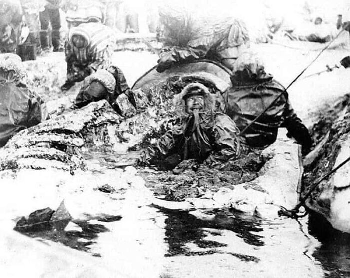 An old black and white photo of people working in a muddy, snowy environment, reminiscent of terrifying methods and tools doctors used.