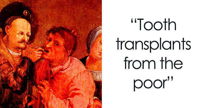 28 Terrifying Methods And Tools That Doctors Used In The Past To Treat Patients