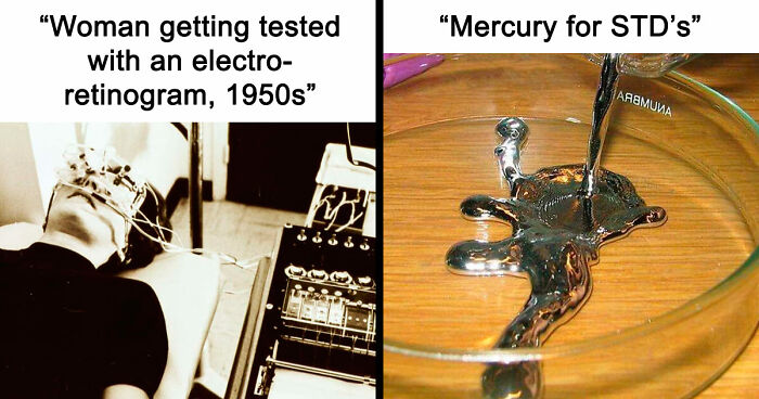 28 Terrifying Methods And Tools That Doctors Used In The Past To Treat Patients