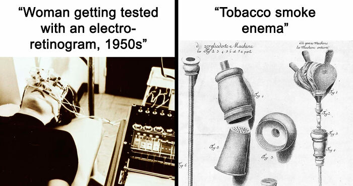 28 Terrifying Methods And Tools That Doctors Used In The Past To Treat Patients